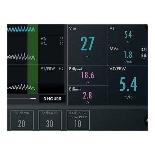Maquet-Servo-U-Display Maquet-Servo-U-Display